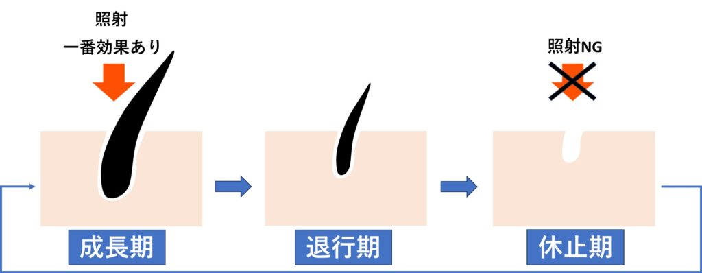ケノンで効果が出やすい毛周期